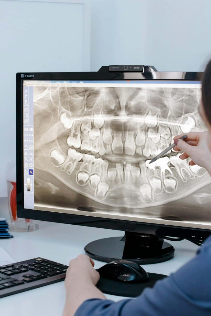 orthodontic scan