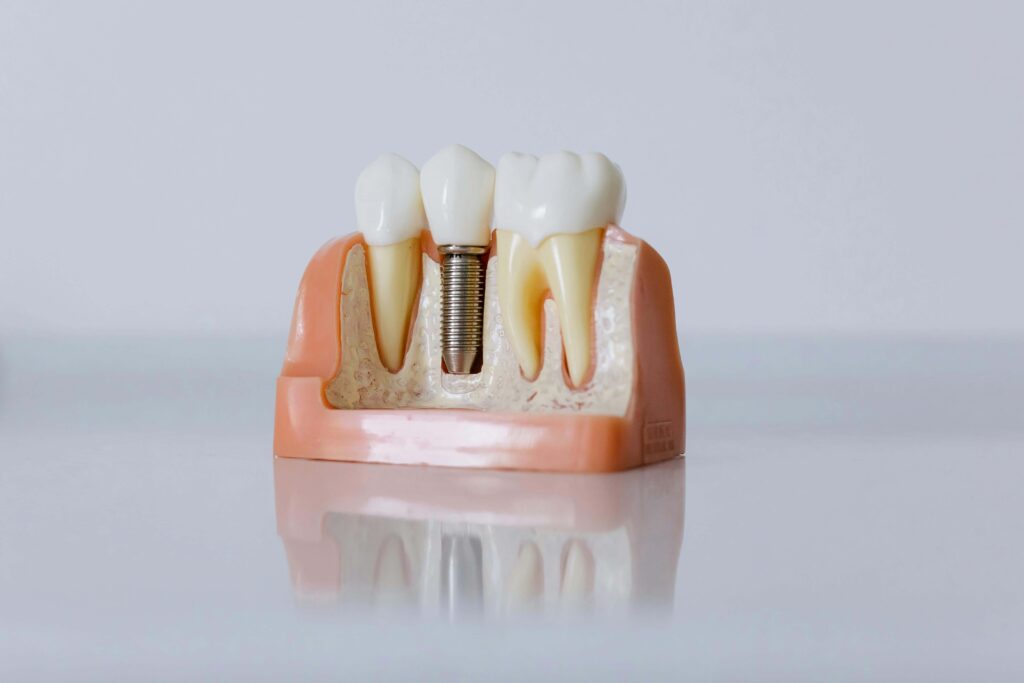 orthodontic model teeth